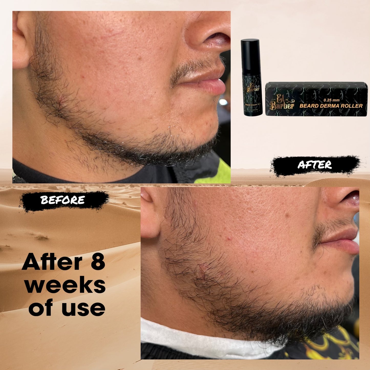 El Barber Beard Growth Kit
